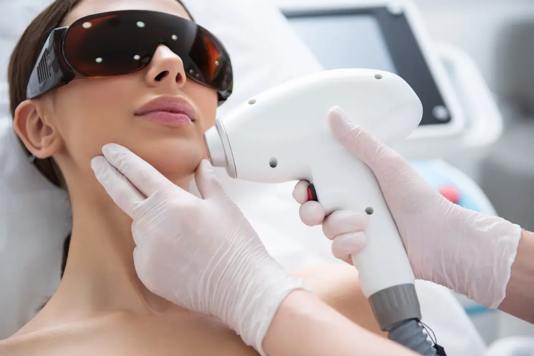 Woman undergoing a laser hair removal on chin.